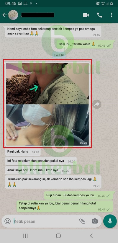 gondok-1.jpg