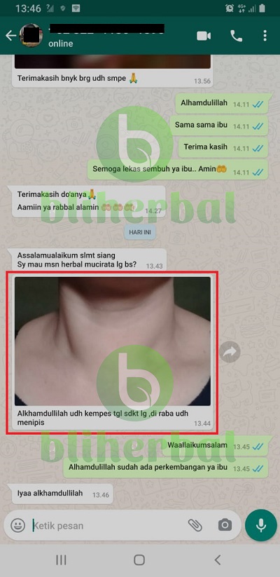 gondok2.jpg