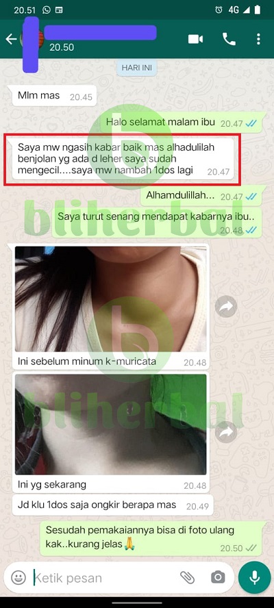 gondok3.jpg